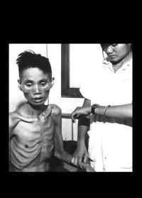 Starving Vietnamese Man